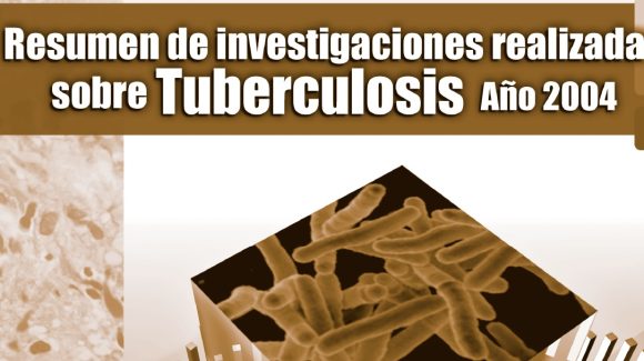 Resumen de investigacion TB Resumen de investigacion TB